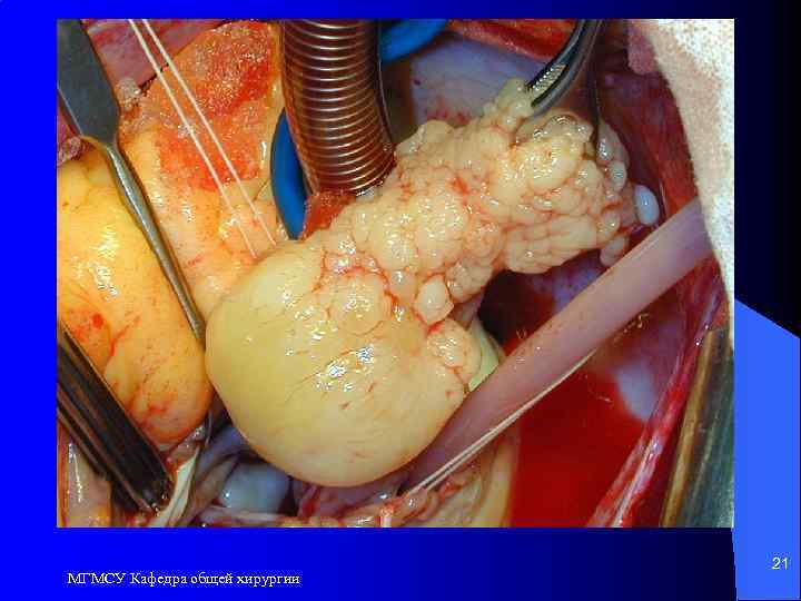 МГМСУ Кафедра общей хирургии 21 