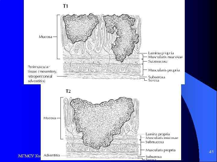 МГМСУ Кафедра общей хирургии 41 
