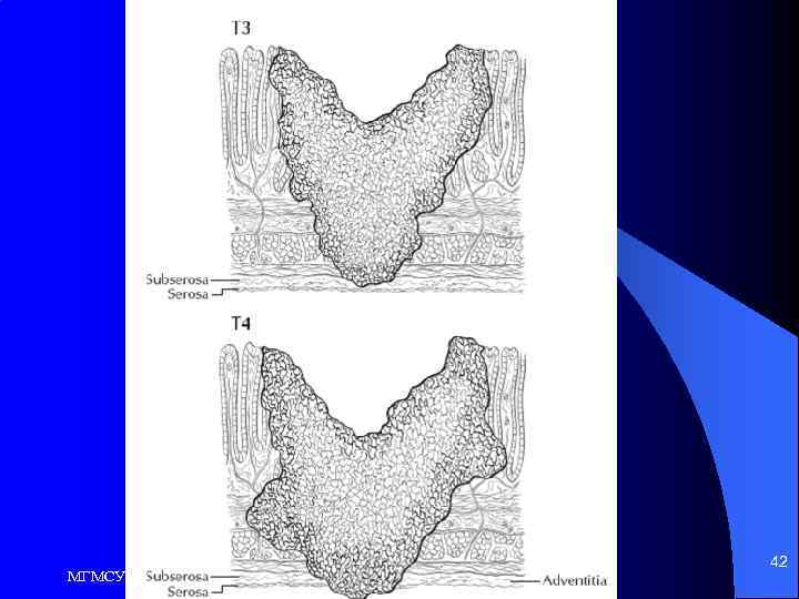 МГМСУ Кафедра общей хирургии 42 