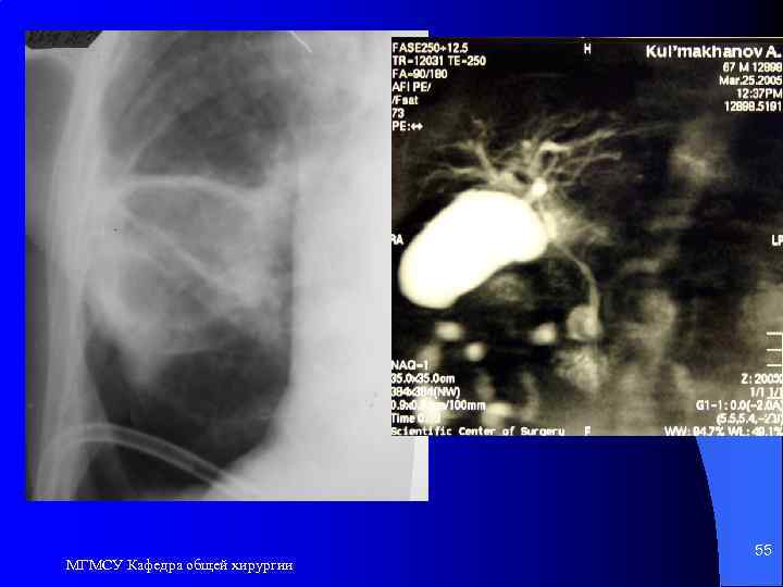 МГМСУ Кафедра общей хирургии 55 