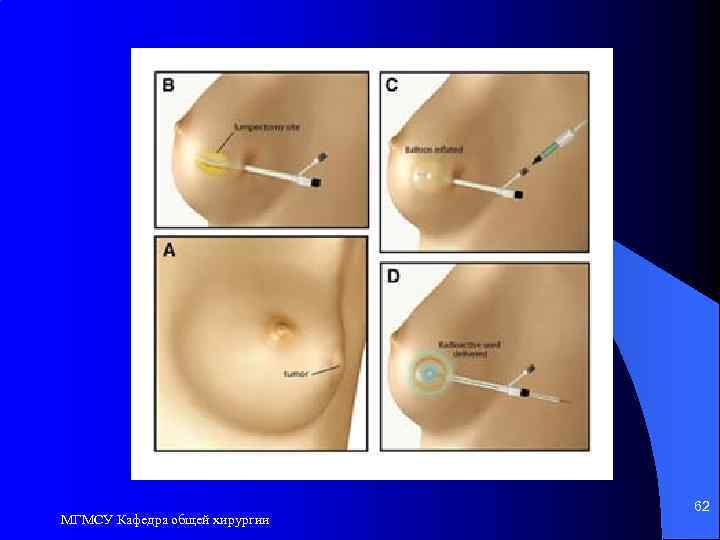 МГМСУ Кафедра общей хирургии 62 