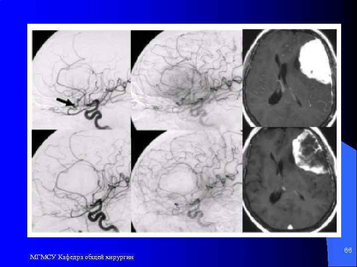 МГМСУ Кафедра общей хирургии 66 