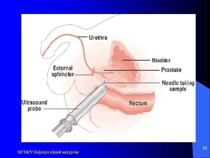 МГМСУ Кафедра общей хирургии 68 