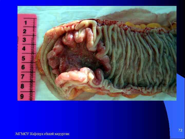МГМСУ Кафедра общей хирургии 72 