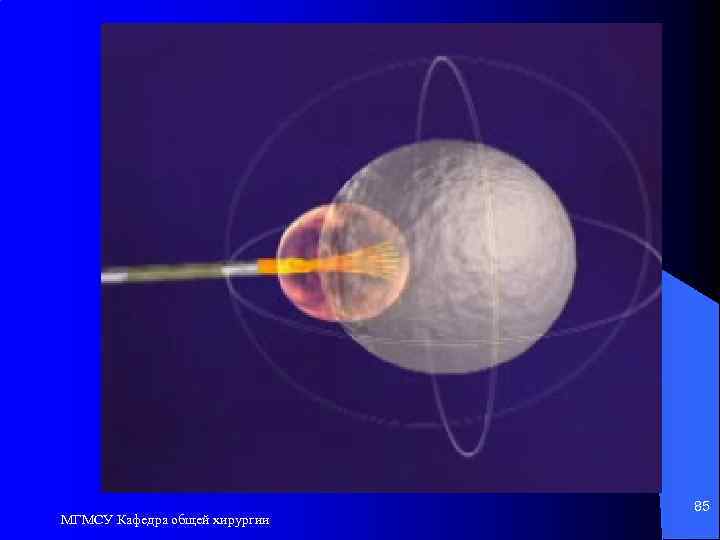 МГМСУ Кафедра общей хирургии 85 