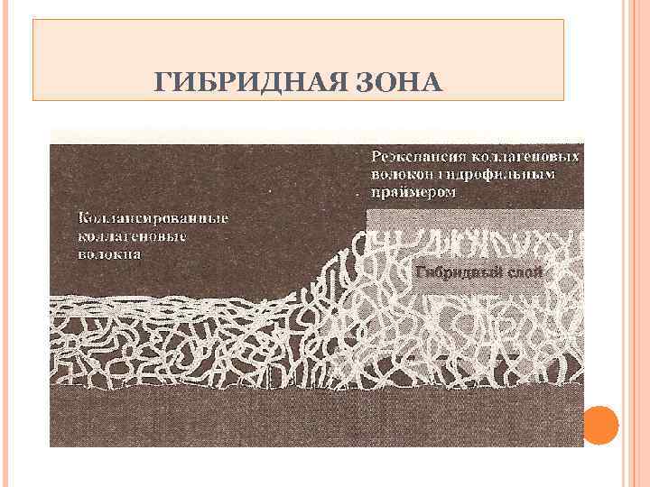 ГИБРИДНАЯ ЗОНА 