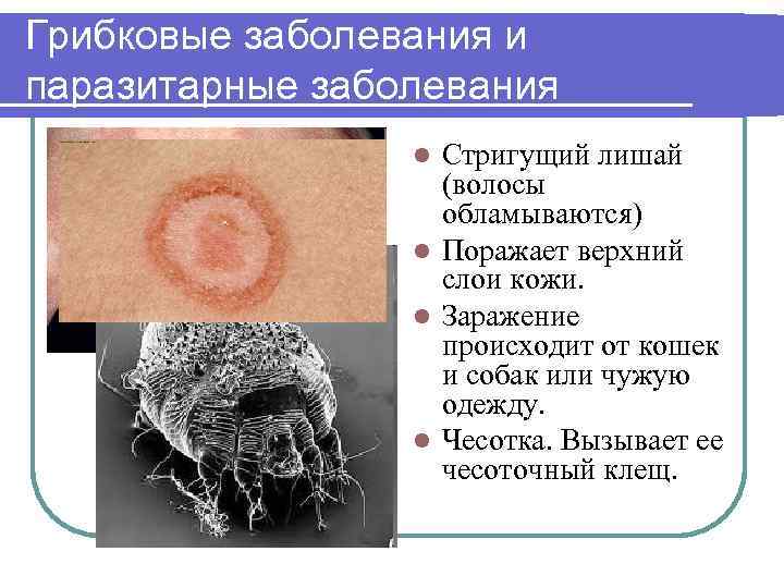 Грибковые заболевания и паразитарные заболевания Стригущий лишай (волосы обламываются) l Поражает верхний слои кожи.