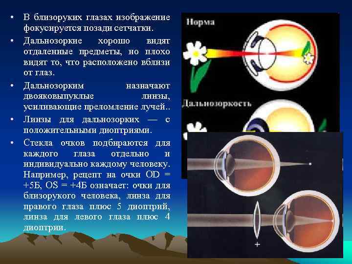  • В близоруких глазах изображение фокусируется позади сетчатки. • Дальнозоркие хорошо видят отдаленные