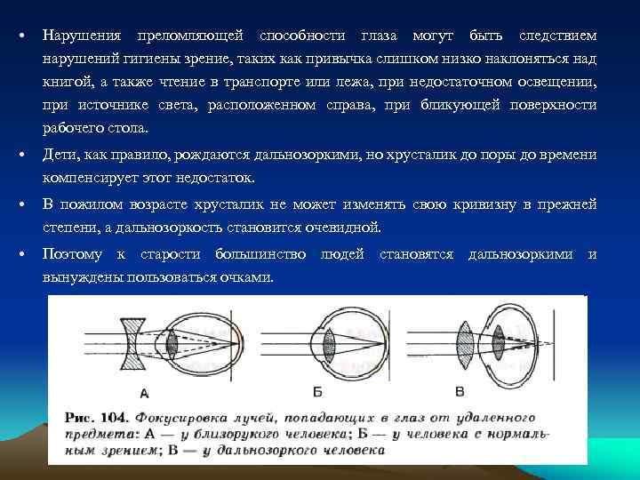  • Нарушения преломляющей способности глаза могут быть следствием нарушений гигиены зрение, таких как
