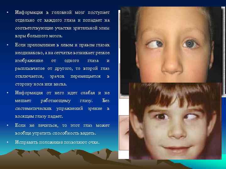  • Информация в головной мозг поступает отдельно от каждого глаза и попадает на