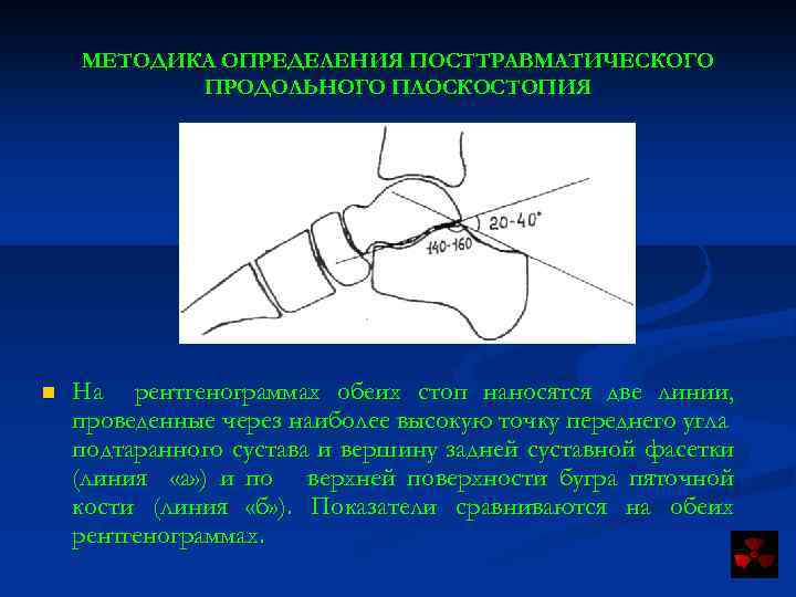 МЕТОДИКА ОПРЕДЕЛЕНИЯ ПОСТТРАВМАТИЧЕСКОГО ПРОДОЛЬНОГО ПЛОСКОСТОПИЯ n На рентгенограммах обеих стоп наносятся две линии, проведенные