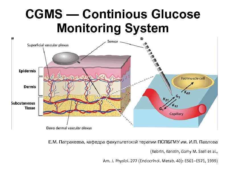 CGMS — Continious Glucose Monitoring System Е. М. Патракеева, кафедра факультетской терапии ПСПБГМУ им.