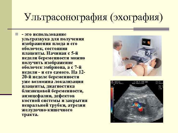 Ультрасонография (эхография) n - это использование ультразвука для получения изображения плода и его оболочек,