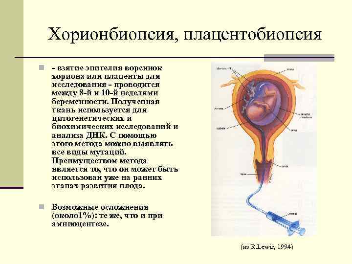 Хорионбиопсия, плацентобиопсия n - взятие эпителия ворсинок хориона или плаценты для исследования - проводится