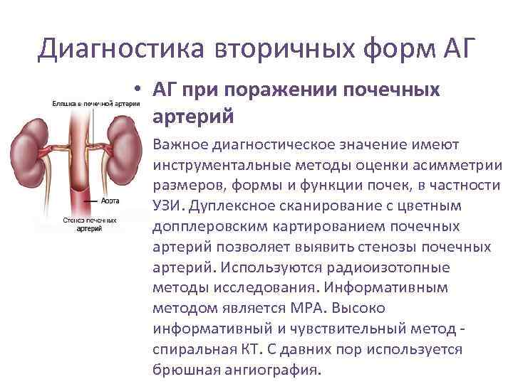 Диагностика вторичных форм АГ • АГ при поражении почечных артерий • Важное диагностическое значение