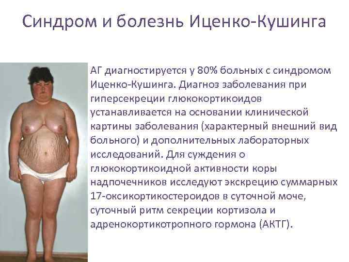 Синдром и болезнь Иценко-Кушинга • АГ диагностируется у 80% больных с синдромом Иценко-Кушинга. Диагноз