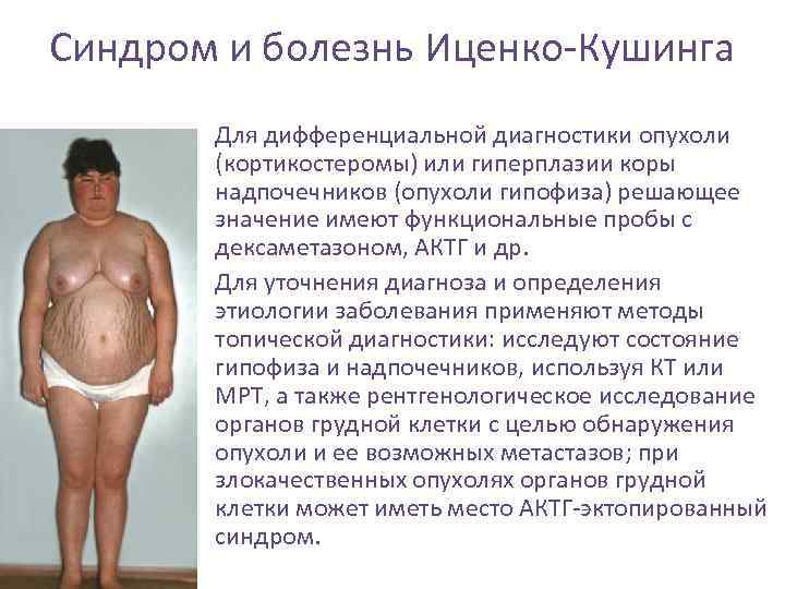 Синдром и болезнь Иценко-Кушинга • Для дифференциальной диагностики опухоли (кортикостеромы) или гиперплазии коры надпочечников