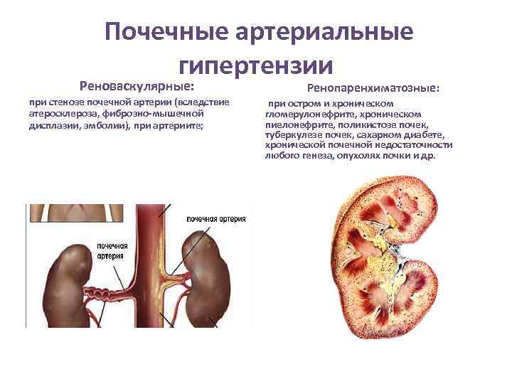 Клиническая картина заболеваний почек