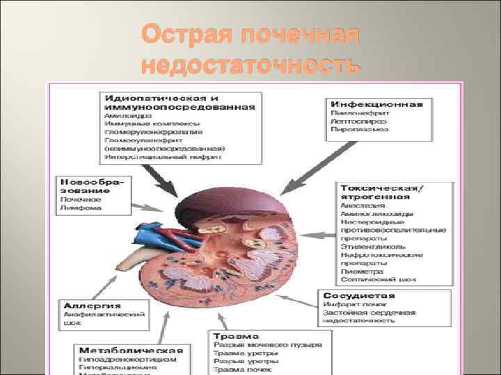 Острая почечная недостаточность 