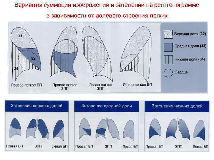 Суммационное изображение это