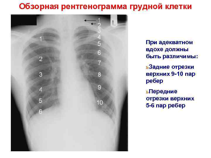 Схема описания рентгенограммы грудной клетки