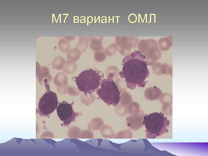 М 7 вариант ОМЛ 