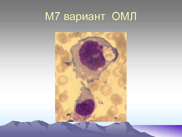 М 7 вариант ОМЛ 