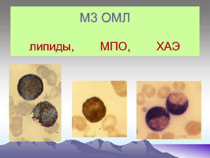 М 3 ОМЛ липиды, МПО, ХАЭ 