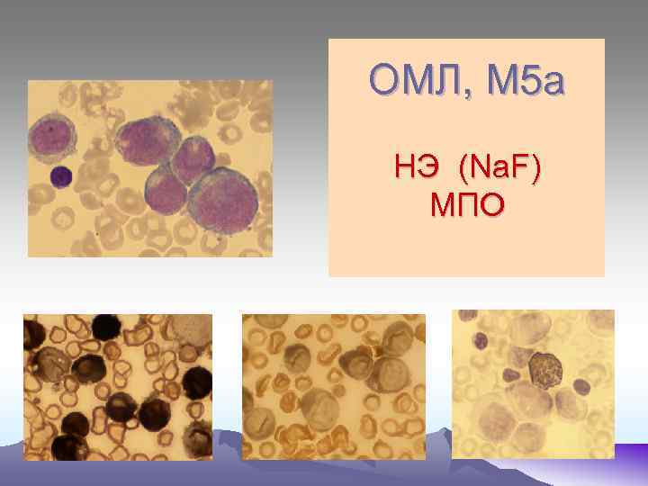 ОМЛ, М 5 а НЭ (Na. F) МПО 