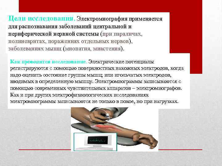 Цели исследования. Электромиография применяется для распознавания заболеваний центральной и периферической нервной системы (при параличах,