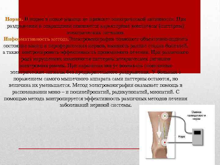 Норма. В норме в покое мышца не прявляет электрической активности. При раздражении и сокращении