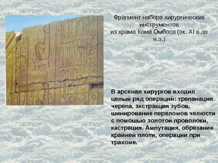 Фрагмент набора хирургических инструментов из храма Кома Омбоса (ок. XI в. до н. э.