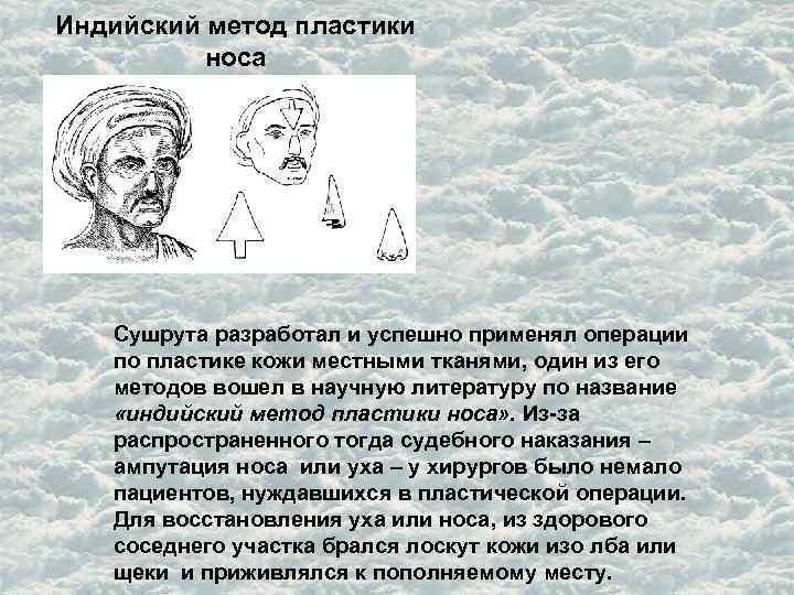 Индийский метод пластики носа Сушрута разработал и успешно применял операции по пластике кожи местными