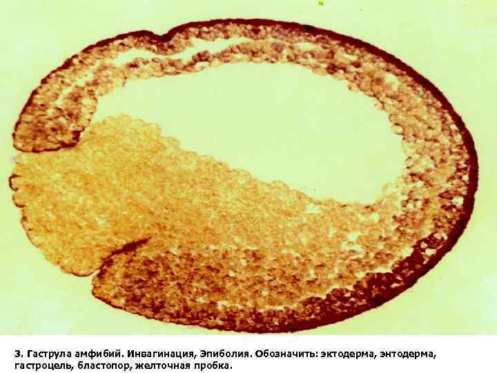 3. Гаструла амфибий. Инвагинация, Эпиболия. Обозначить: эктодерма, энтодерма, гастроцель, бластопор, желточная пробка. 