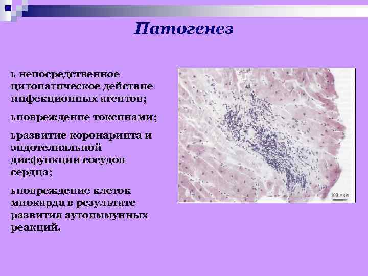 Патогенез ь непосредственное цитопатическое действие инфекционных агентов; ь повреждение токсинами; ь развитие коронариита и