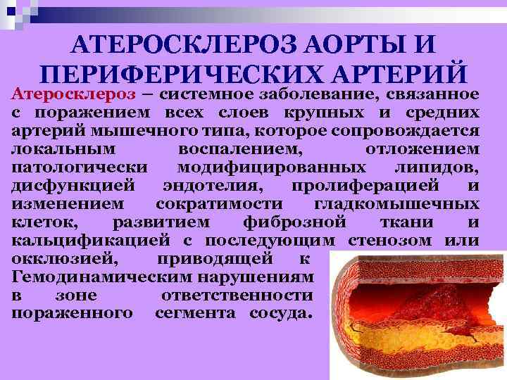 Атеросклероз аорты и артерий