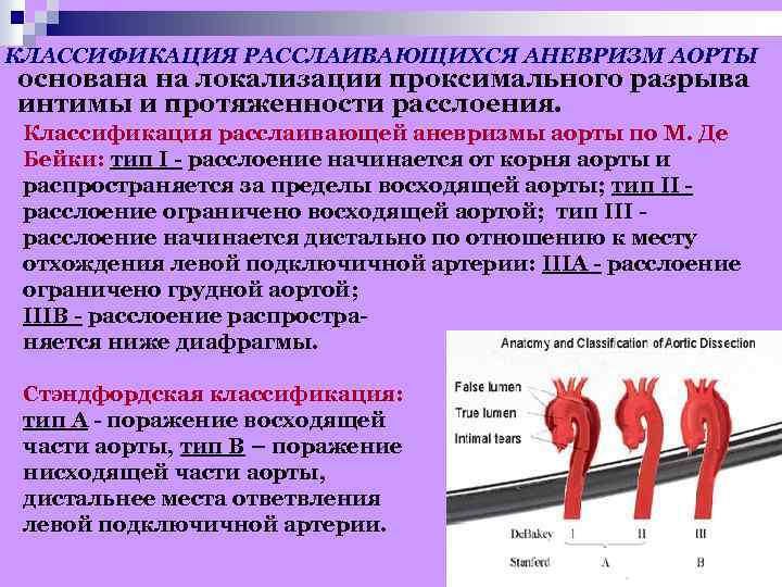 Аневризмы аорты рекомендации