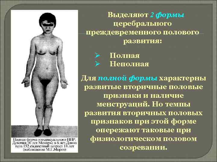 Выделяют 2 формы церебрального преждевременного полового развития: Ø Ø Полная Неполная Для полной формы