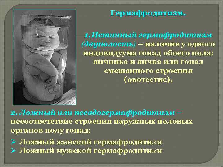 Гермафродитизм. 1. Истинный гермафродитизм (двуполость) – наличие у одного индивидуума гонад обоего пола: яичника