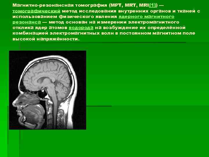 Магнитно-резонансная томография (МРТ, MRT, MRI[1]) — томографический метод исследования внутренних органов и тканей с