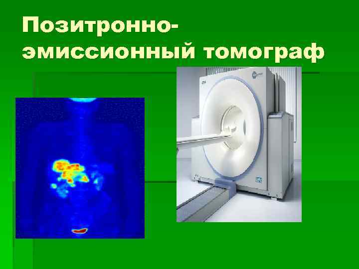 Позитронноэмиссионный томограф 