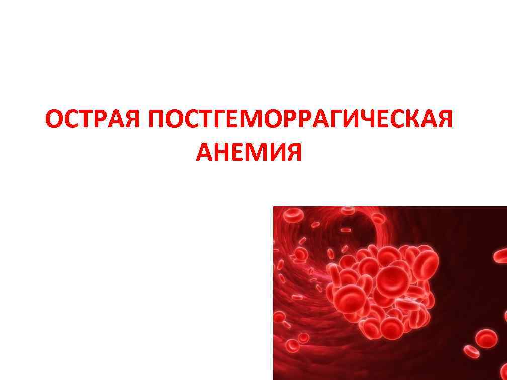 Постгеморрагическая анемия картинки