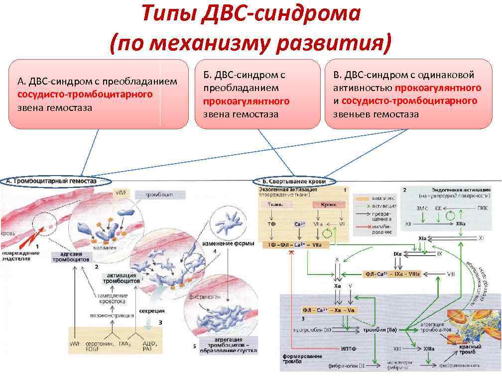  Типы ДВС-синдрома (по механизму развития) Б. ДВС-синдром с В. ДВС-синдром с одинаковой А.