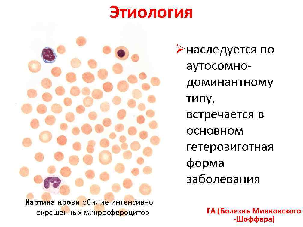 Талассемия картина крови