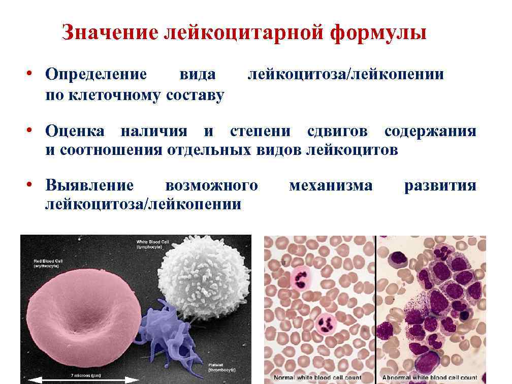  Значение лейкоцитарной формулы • Определение вида лейкоцитоза/лейкопении по клеточному составу • Оценка наличия