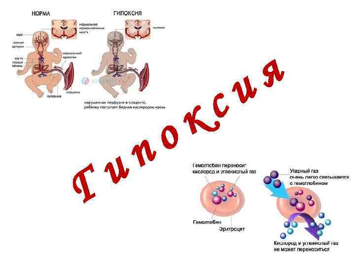 и Г о п с к я и 