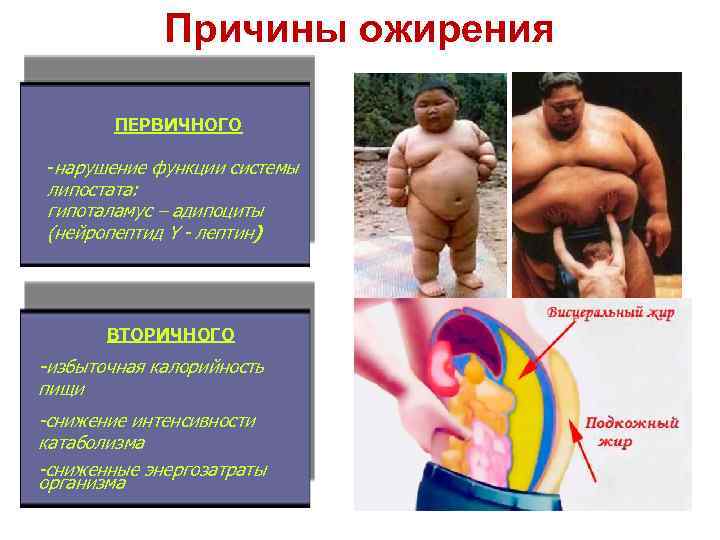 Причины ожирения ПЕРВИЧНОГО -нарушение функции системы липостата: гипоталамус – адипоциты (нейропептид Y - лептин)