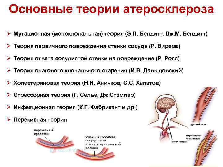 Основные теории атеросклероза Ø Мутационная (моноклональная) теория (Э. П. Бендитт, Дж. М. Бендитт) Ø