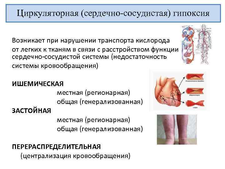 Циркуляторная (сердечно-сосудистая) гипоксия Возникает при нарушении транспорта кислорода от легких к тканям в связи