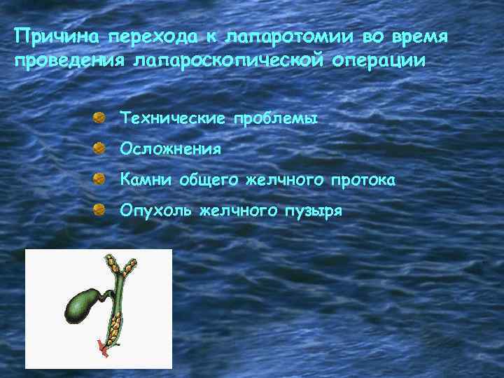 Причина перехода к лапаротомии во время проведения лапароскопической операции Технические проблемы Осложнения Камни общего